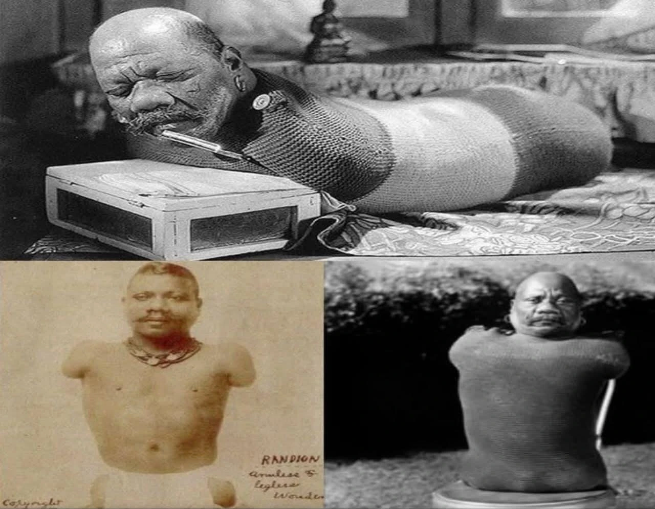  ಮಾನವ ಕಂಬಳಿಹುಳು – ಶಕ್ತಿಯನ್ನು ಮರು ವ್ಯಾಖ್ಯಾನಿಸಿದ ಮನುಷ್ಯ